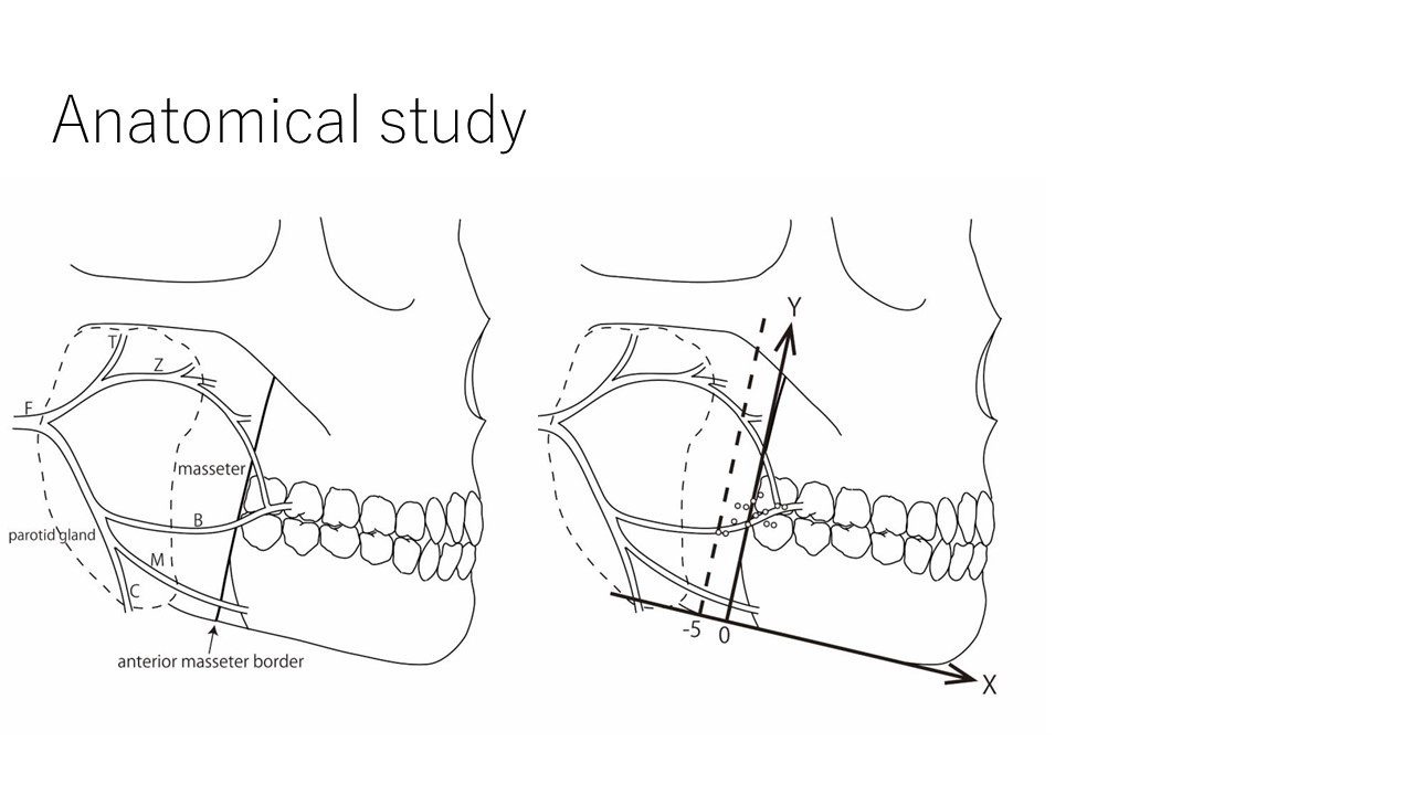 pre-masseter spaceにおける顔面神経の走行の研究by神戸大学美容外科